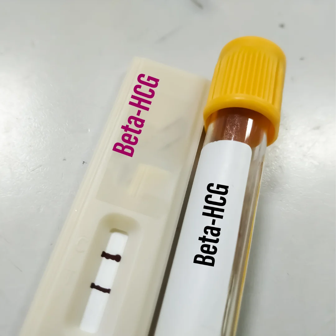 BASIC PREGNANCY BLOOD TEST