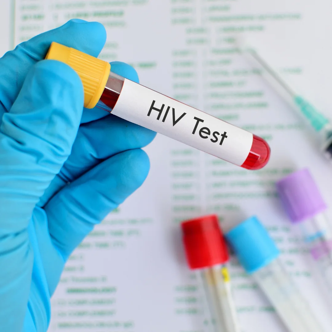 HIV Tests